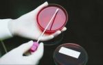 Allergietests - auf der Suche nach den Ursachen