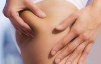 Orangenhaut und Dehnungsstreifen  - Tipps zur Strkung der Bindehautstruktur