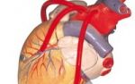 Vorbeugung gegen Arteriosklerose - Vitalstoffe helfen