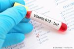 Vitamin B12 Test
